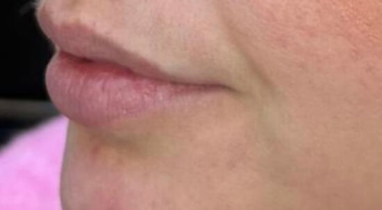 Facial Aesthetics Case 1 before